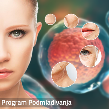 podmlađivanje matične ćekije