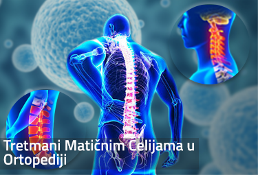 ortopedija lečenje matičnim ćelijama