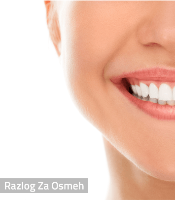 stomatologija fasete