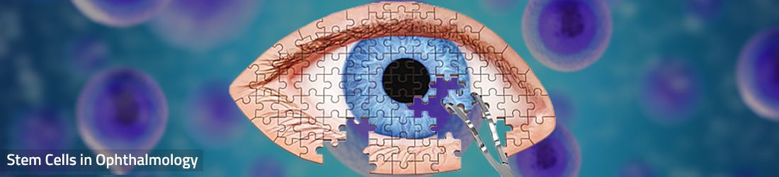 otalmologija maticne celije